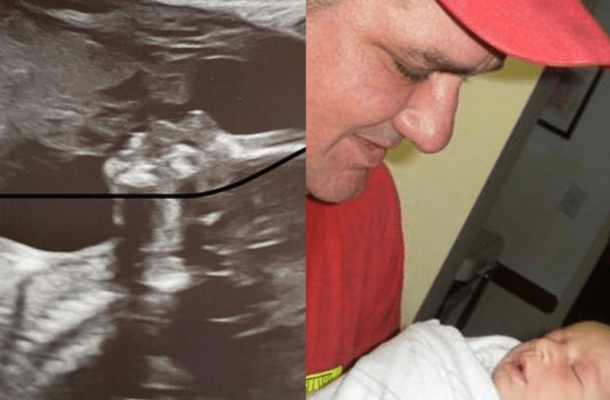 PHOTO: Mother shocked as she spots her “late father kissing her unborn daughter”