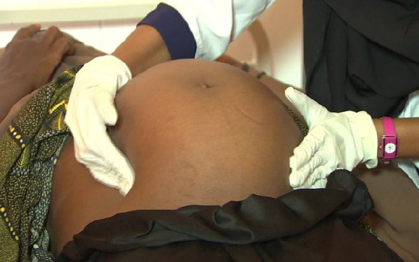 Pregnant sickle cell patient struggling for life amid strike by nurses