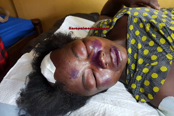 Wife beaten to a pulp after husbands catches her in bed with another man