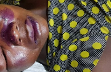 PHOTO: Husband beats wife after catching her having s3x with another man