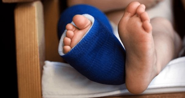 Upper East Regional Hospital records high cases of fractures in children