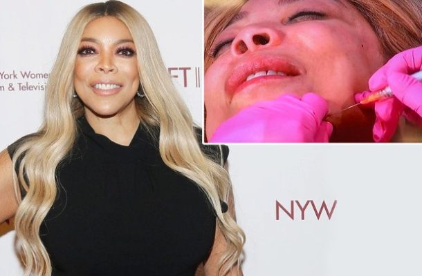 Wendy Williams injected with facial fillers on her daytime talk show