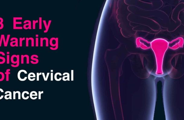 4 women die daily from cervical cancer, seek early treatment - Doctor