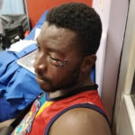 I would have run away If I knew Patrick Allotey was a boxer - Victim of assault