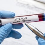 Govt delays in updating Coronavirus figures creating mistrust – CDD