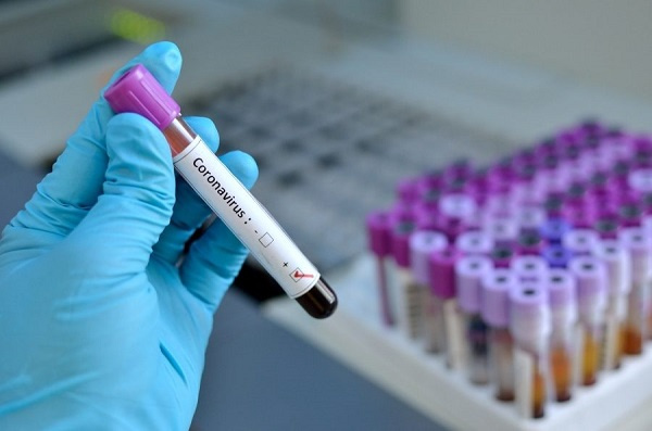 $1 testing kits: Senegal's approach to coronavirus