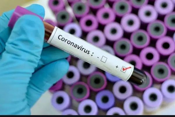 People in Koforidua not observing directives against Coronavirus