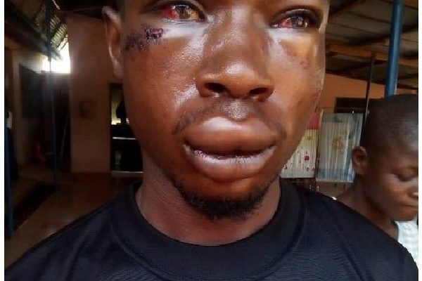 CID man brutalizes student for chasing his wife