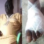 Ejura MP ‘crippled’ after deadly attack; says he can’t campaign for 2020 polls