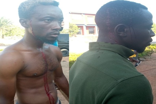 NPP PC’s bodyguards attack registration centre; 5 persons injured