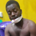PHOTO: Irate youth chop off man’s hand at Aboabo