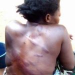 Lady brutally assaulted by boyfriend for asking him to marry her