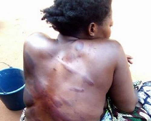 Lady brutally assaulted by boyfriend for asking him to marry her