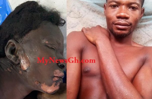 Nakpanduri: 64 yr old woman burnt alive by 2 men for refusal to rent out her tricycle at 1am