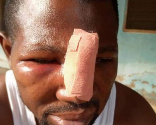 Nungua: JHS student and his gang attack teacher over homework
