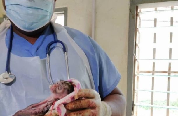 Kumasi Zoo monkey gives birth through a C-Section