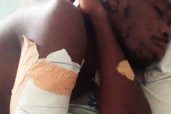 Man loses arm after police assault at Asutsuare
