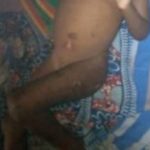 PHOTOS: Father allegedly burns his 3-year-old daughter at Obuasi