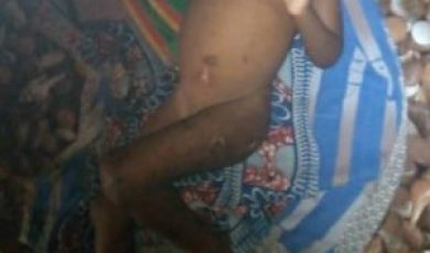 PHOTOS: Father allegedly burns his 3-year-old daughter at Obuasi