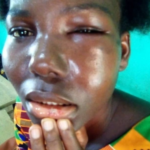 Lady beaten by brother-in law over a sachet water