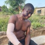 Ga West: Party coordinator left with fractured arm after attack from MCE's 'boys'