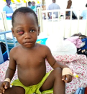Help save the life of little Paul Teye from cancer