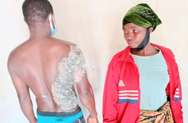 20-yr-old woman sentenced to 17 years imprisonment with hard labour for pouring hot water on her husband