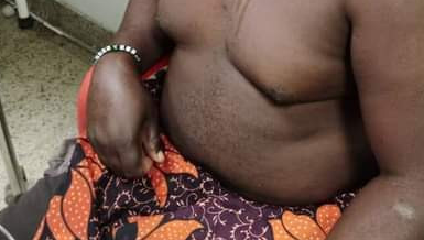 Woman pours hot cooking oil on her husband [Photos]