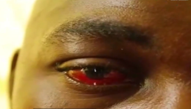 Man in Wa flogging video on the verge of losing eye