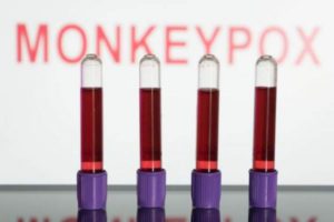 Monkeypox: US declares outbreak a public health emergency