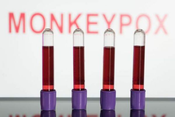 Monkeypox: US declares outbreak a public health emergency