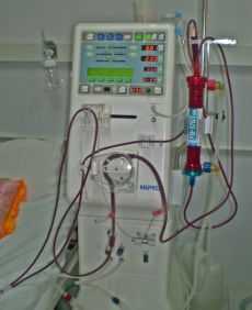 Bolgatanga Regional Hospital cries for Dialysis Centre