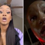 American influencer alleges bloody assault by bouncer at Ghana night club