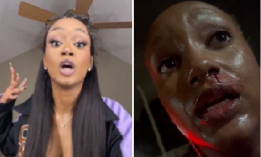 American influencer alleges bloody assault by bouncer at Ghana night club