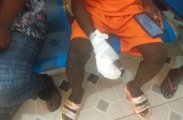 E/R: 17 year-old Boy losing fingers after ‘Pastor’ scalds palm over missing Ghc600