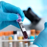 Breakthrough Blood Test Detects Early-Stage Cancer: Exciting Advancement in Cancer Detection