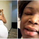 My life is ruined, all my money is being spent on diapers - Nigerian transgender cries after botched surgery