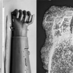 Unveiling History: A 600-Year-Old Iron Prosthetic Hand Unearthed in Germany