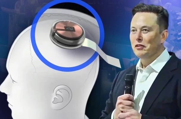 Elon Musk Reveals: Patient with Neuralink Chip Controls Computer Mouse Using Mind