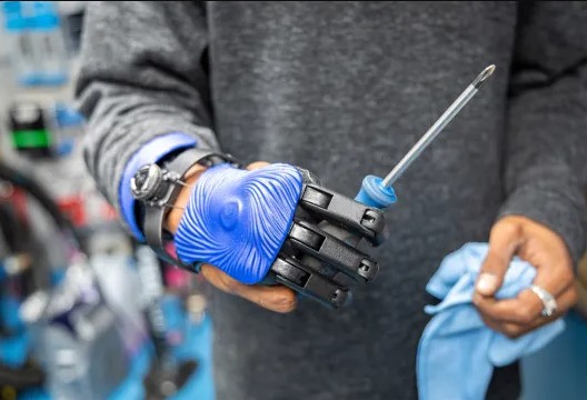 Revolutionary Breakthrough: English Man Receives 3D-Printed Bionic Fingers