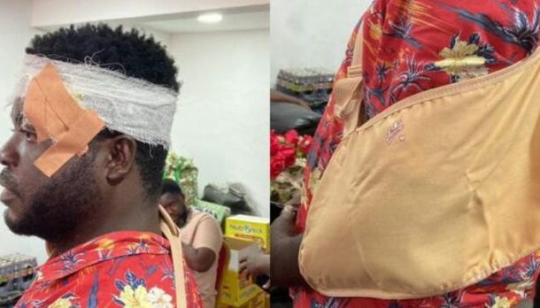 TESCON member sustains head injury after alleged assault by NDC supporters in Kumasi