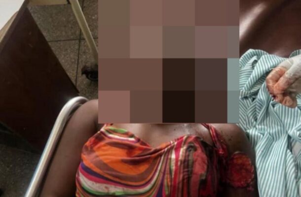 Young woman shot dead in Pru East by boyfriend