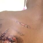 Mother burns 11-year-old son with hot iron in Ho