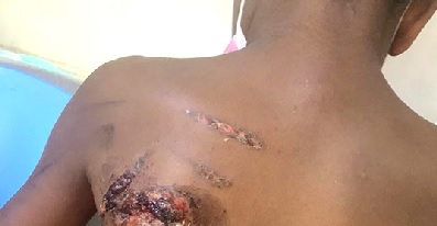 Mother burns 11-year-old son with hot iron in Ho