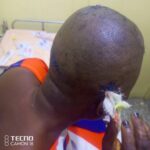 Kasoa: Gold dealer nearly kills fiancée over cheating allegations