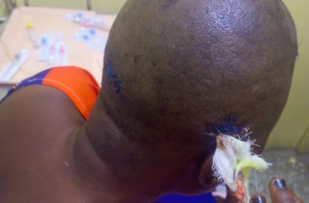 Kasoa: Gold dealer nearly kills fiancée over cheating allegations