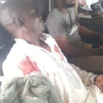 Gunfire erupts in Okorase over land dispute; Zongo chief among injured