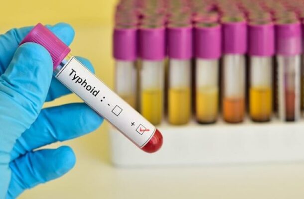 Oti Region records alarming typhoid fever cases