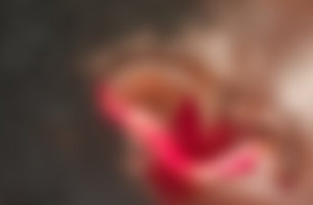 Dambai man arrested for allegedly biting off wife’s ear granted bail