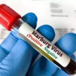 GHS on high alert amid Marburg virus outbreak in Ethiopia